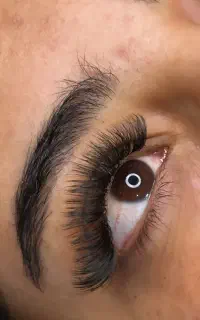 کاشت مژه