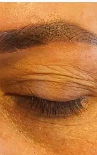 تتو‌صورت
