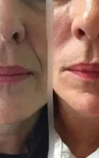 کرم ۵ کاره بیوممتیک شبه بوتاکس مستقیما از کارخانه