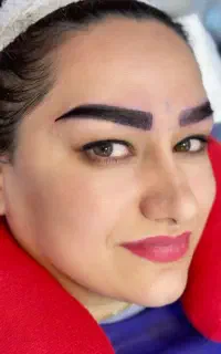 کاشت ابروی طبیعی با تکنیک کاشت تخصصی در رشت