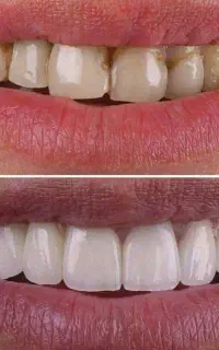 استخدام نیروی  مستخدم (نظافت چی) در درمانگاه بوعلی