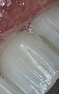 قم عزیز مژده کامپوزیت قسط بدون پرداخت