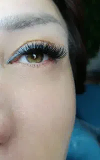 کاشت هیدن مژه
