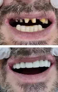 مرکز روکش دندان و کامپوزیت