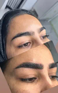 میکروبلیدینگ ابرو