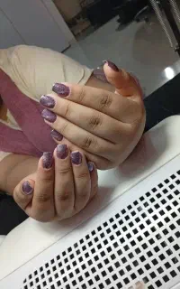 کاشت ناخن،