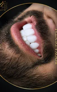دندانپزشکی کامپوزیت فکی فقط (۱۷)م ارتودنسی