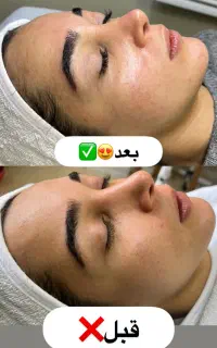 فیشال و پاکسازی تخصصی پوست با بهترین متریال