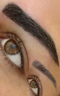 تزریق فیلر وبوتاکس و مزوتراپی وفیلر زیر چشم