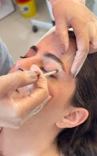 آموزش تزریق فیلر بوتاکس ژل و فیلر بادی توسط پزشک