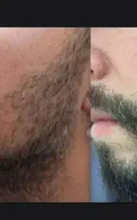 ریشاتو چمن کن
