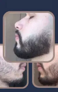 رویش مو