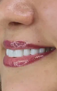 بیمه تخفیف طلایی شو