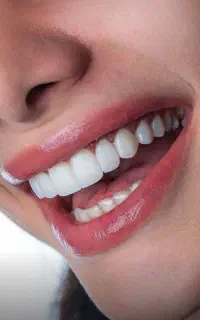 کامپوزیت دندان /زیبایی/ایمپلنت/ترمیمی/ عصب کشی