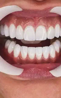 آموزش کامپوزیت و دندانپزشکی برای همه ی افراد