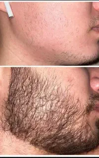 ریش پرپشت چهره جذاب تر