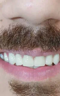 ساخت دندان مصنوعی و انواع خدمات دندانی