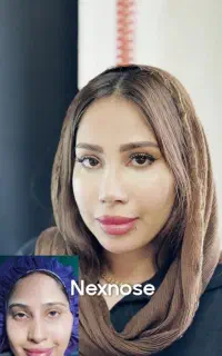 جراحی بینی فقط با قیمت ۳۶ میلیون