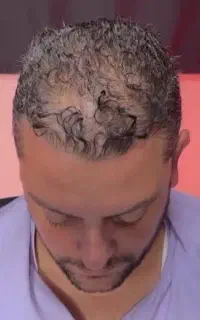 ورود کچلا ممنوع