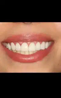 کاهش قیمت ها و تخفیفات عالی درخدمات دندانپزشکی