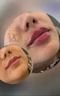 خدمات کلینیک زیبایی نیکا با تخفیف ویژه فصل
