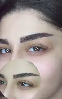 متخصص میکرووفیبروز