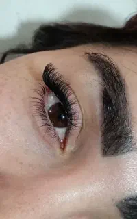 اکستنشن و کاشت هیدن