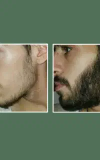 بمب پر پشتی