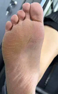 پدیکور و کفسابی تخصصی (درمان قطعی ترک پا)