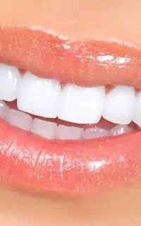 ارتودنسی،کامپوزیت، لمینت،ایمپلنت