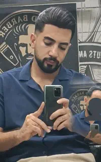 پروتز مو ، نصب فوری ، انجام خدمات