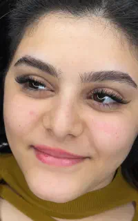 کاشت و اکستنشن مژه