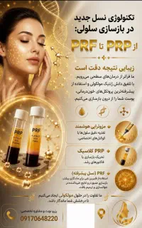 انجام پی آر پی مزوتراپی