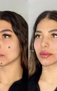 زیبایی عقب ننداز الان انجام بده ۱۲ ماهه پرداخت کن