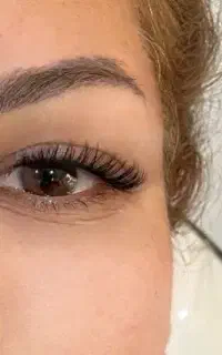 *کاشت مژه تخفیف ویژه*