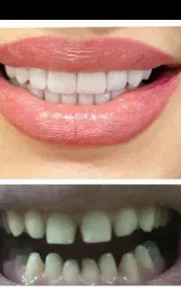آموزش کامل دندانپزشکی بصورت اقساط