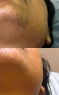 خانه لیزر صدرا(4طول موج)باقابلیت روشن کنندگی پوست