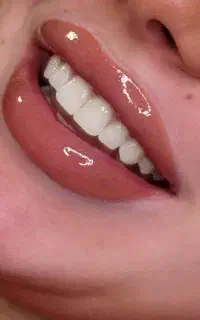 تخفیف باور نکردنی میکروبلیدینگ وشیدینگ لب