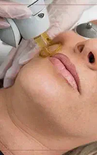آموزش لیزر مو های زائد