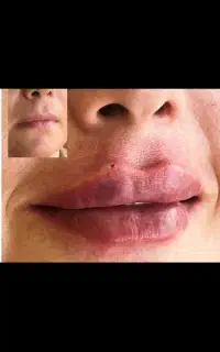تخفیفات زیبایی دکتر هوشمندی