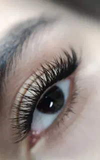 کاشت هیدن و اکستنشن