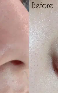 پاکسازی پوست فقط ۲۵۰ به مدت یک هفته