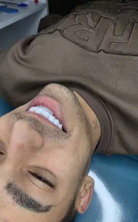 کامپوزیت دندان نقد و اقساط با بهترین متریال
