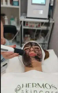آف فیشال و پاکسازی تخصصی پوست