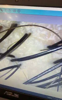 پاکسازی کف سر و اسکراب اسکالپ ۴۰۰