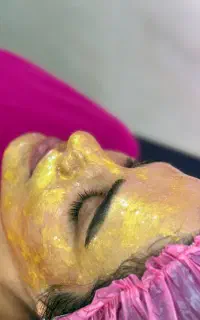 فیشیال جوانسازی لیفتینگ رفع چین وچروک روشن سازی