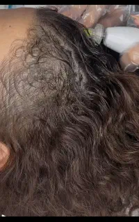 تخفیف ویژه پی آر پی