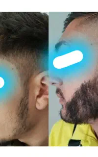 یک تغییر جذاب برای فرم و ظاهر صورت