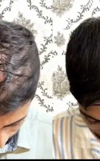 اگه مو نداری پیام بده