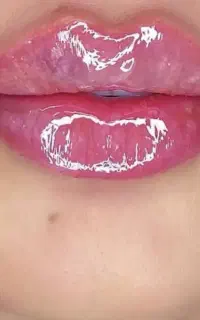 ژل‌  هر سی سی ۳۵۰بوتاکس ۴۵۰اموزش ۵۹۰۰ و لیزر ۲۹۹